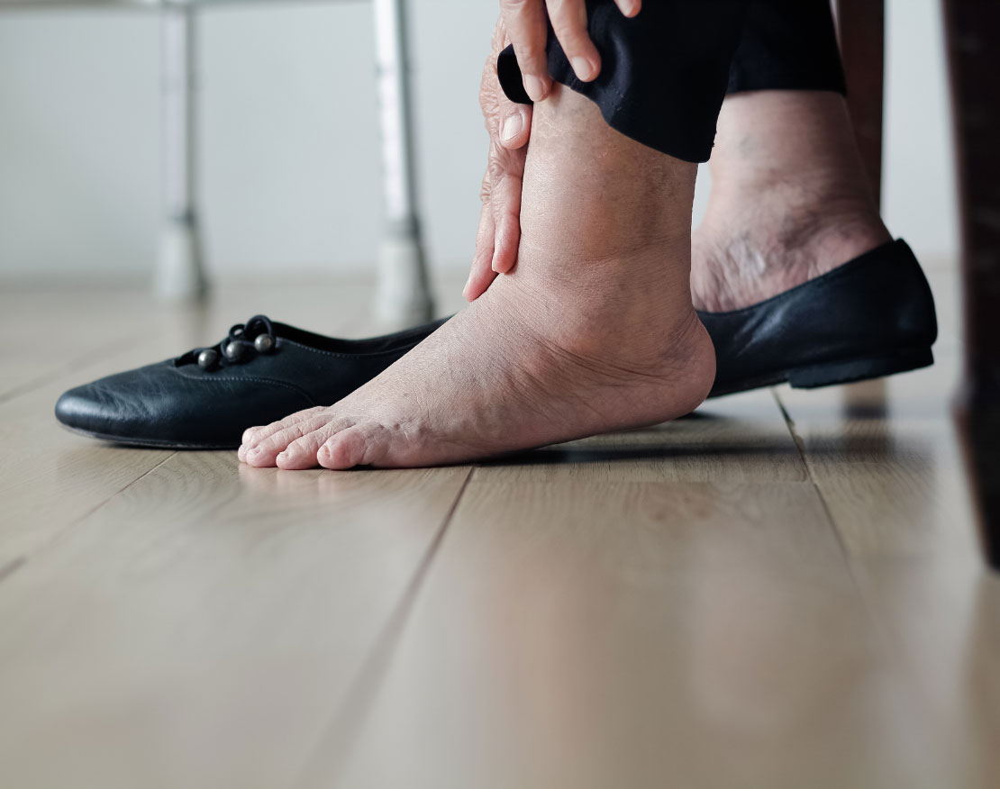 Regula 5 de prevenție a piciorului diabetic: alege încălțămintea potrivită!
